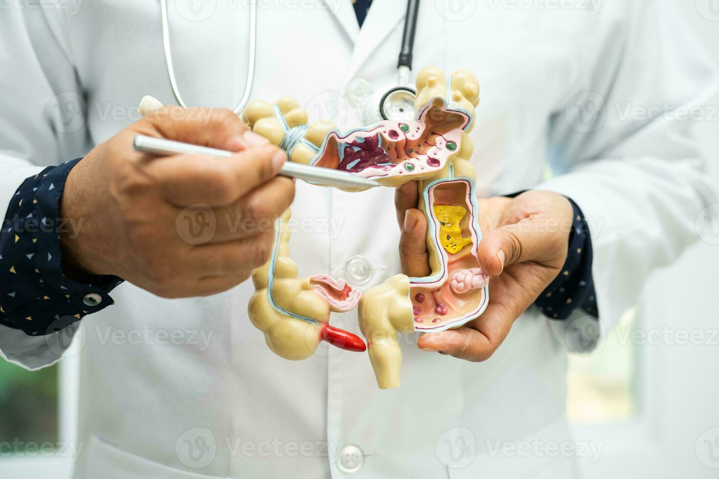 intestino, apêndice e digestivo sistema, médico segurando anatomia modelo para estude diagnóstico e tratamento dentro hospital. foto