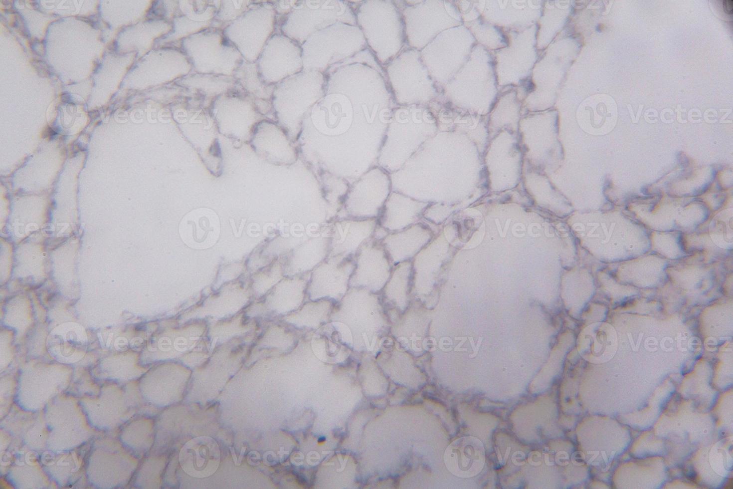 seção de agaricus sob o microscópio foto