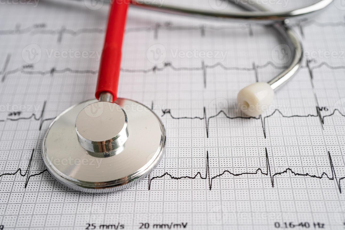 estetoscópio no eletrocardiograma ecg, onda cardíaca, ataque cardíaco, relatório do eletrocardiograma. foto