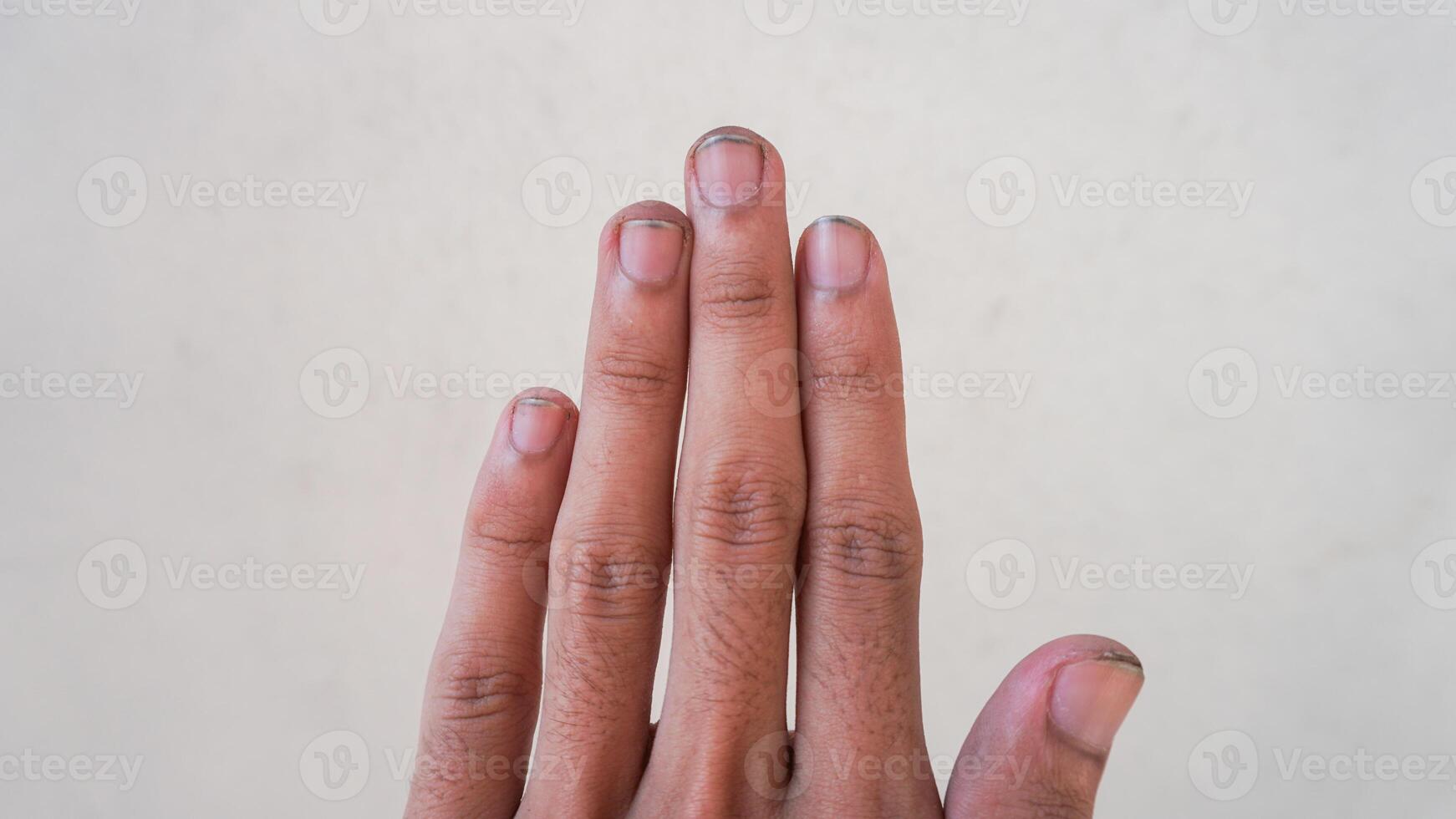 fechar acima mão Cuidado com unha clipper. homem é limpeza e corte fechar as unhas acima do unhas cheio do sujeira. foto do Preto unhas