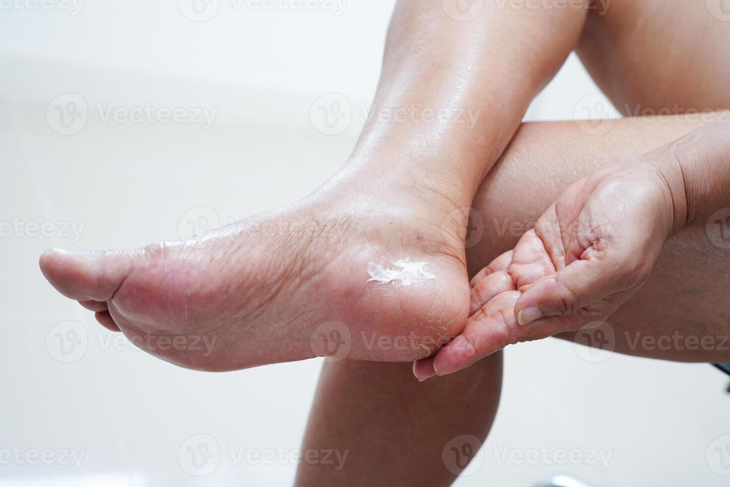 ásia mulher aplicando hidratante creme cuidados com a pele tratamento para resolver e reparar pés com rachadura e seco salto pele. foto