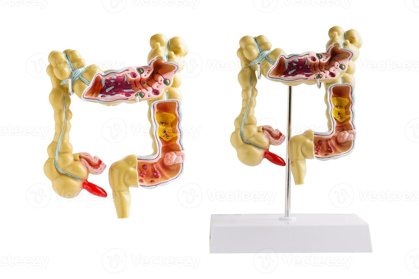 intestino modelo isolado em branco fundo, médico segurando anatomia modelo para estude diagnóstico e tratamento dentro hospital. foto