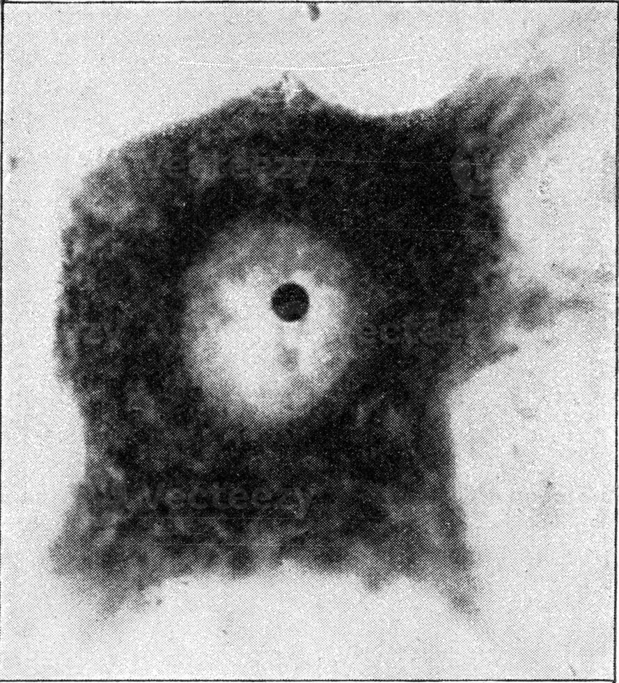 nervo célula com Está núcleo e uma pequeno corpúsculo núcleo muito fortemente ampliado, vintage gravação. foto