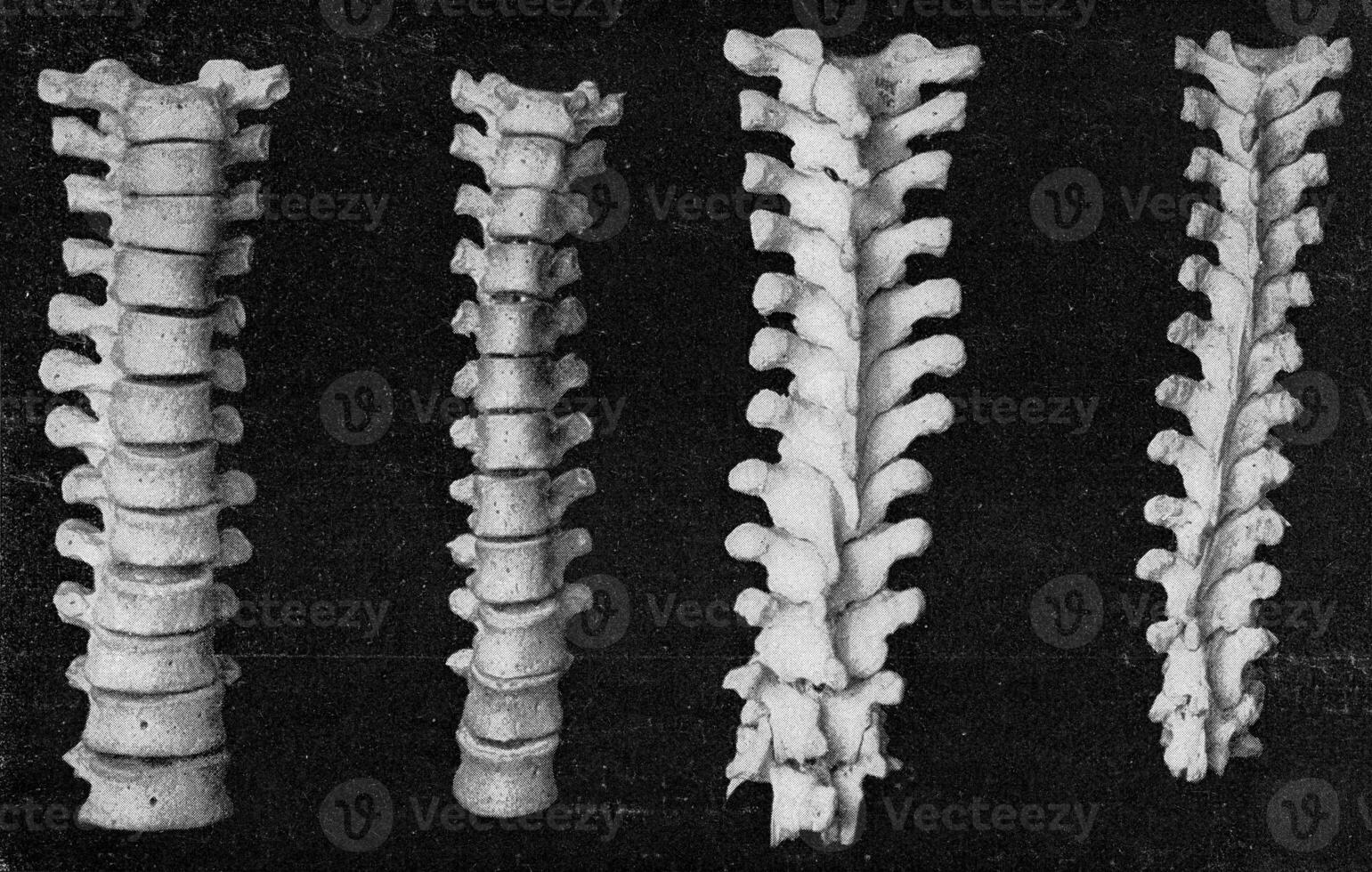 comparativo mesa do a vertebral coluna do a seio e a fêmur do uma europeu e a australiano, vintage gravação. foto