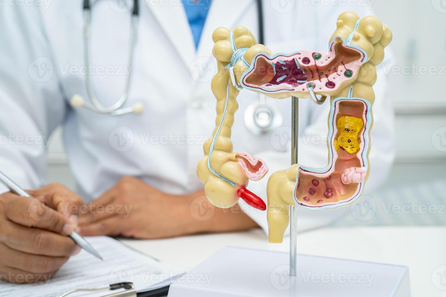 intestino, apêndice e digestivo sistema, médico segurando anatomia modelo para estude diagnóstico e tratamento dentro hospital. foto