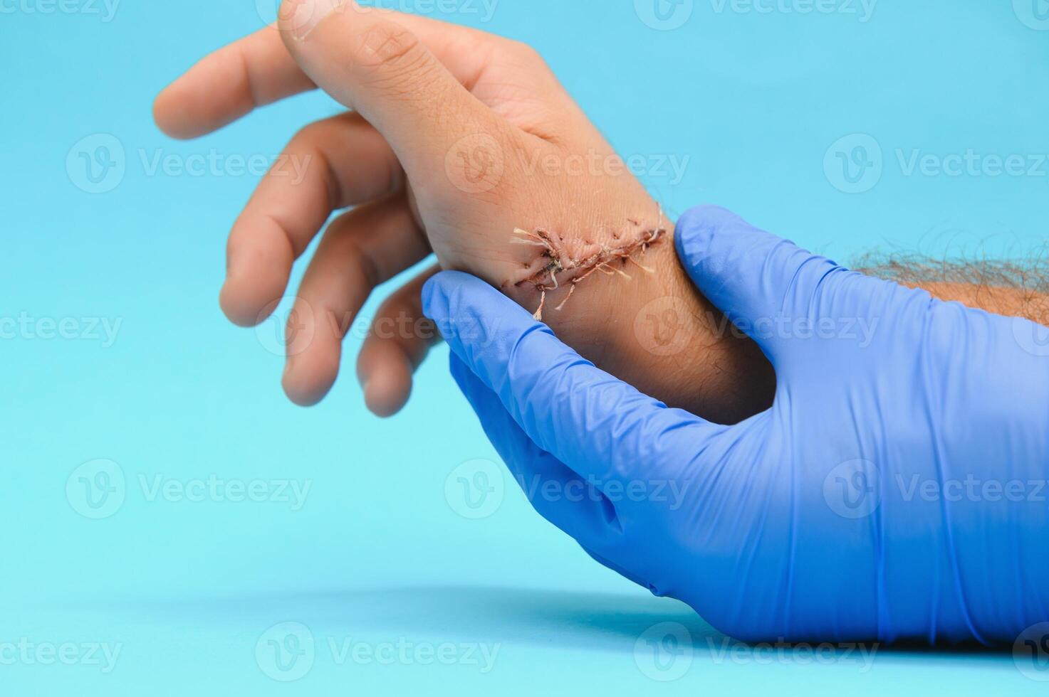 exame de uma médico do uma cortar em a braço foto
