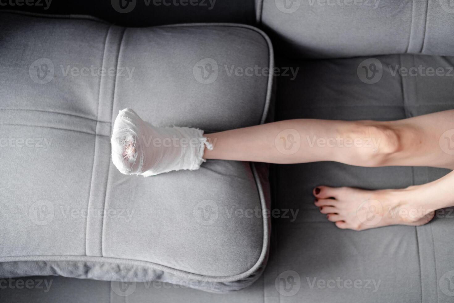 mulher com lindo, grandes pernas e uma fundida em dela certo perna com muletas mentiras em a sofá, topo Visão foto