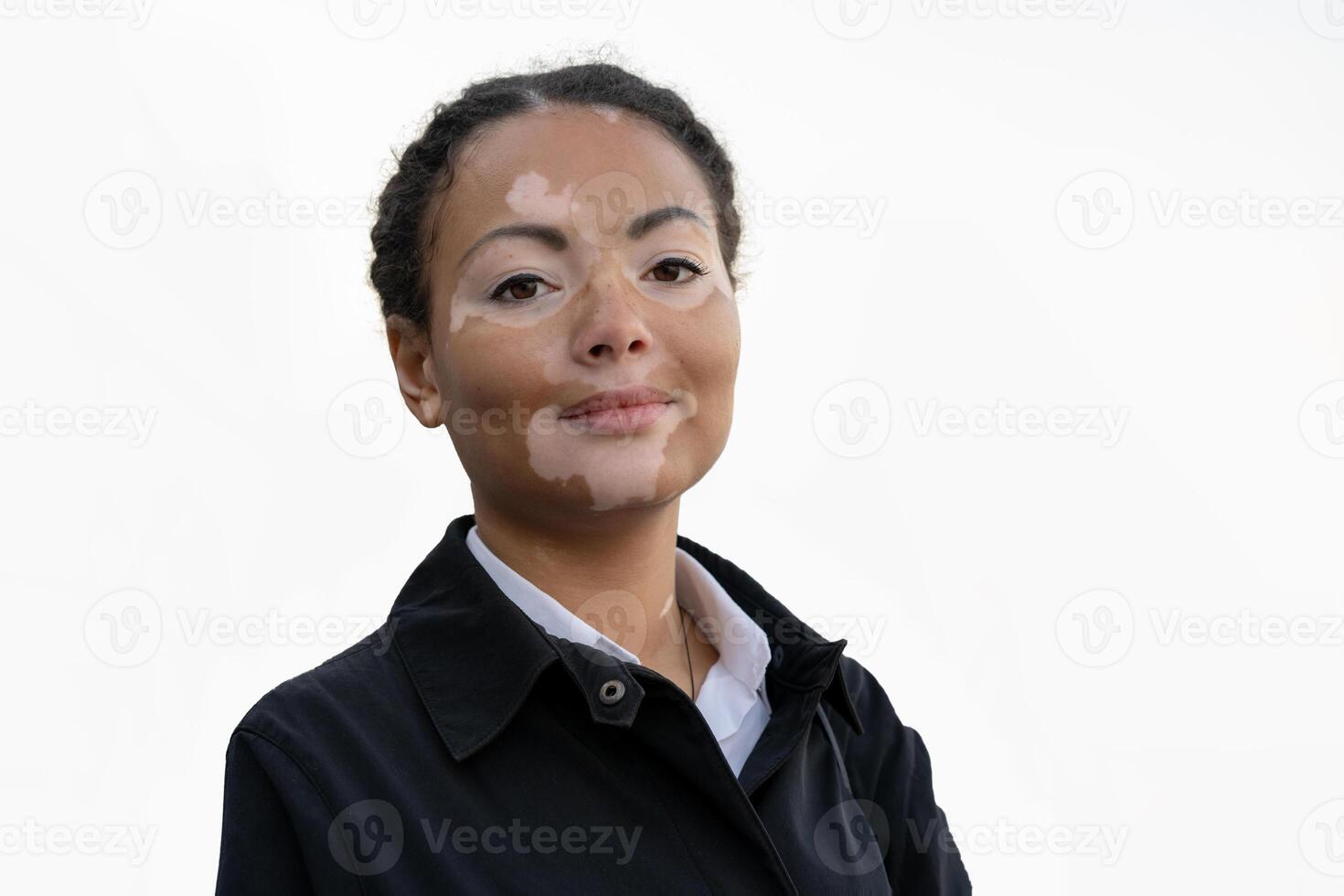 uma lindo jovem menina do africano etnia com vitiligo isolado em a branco fundo foto