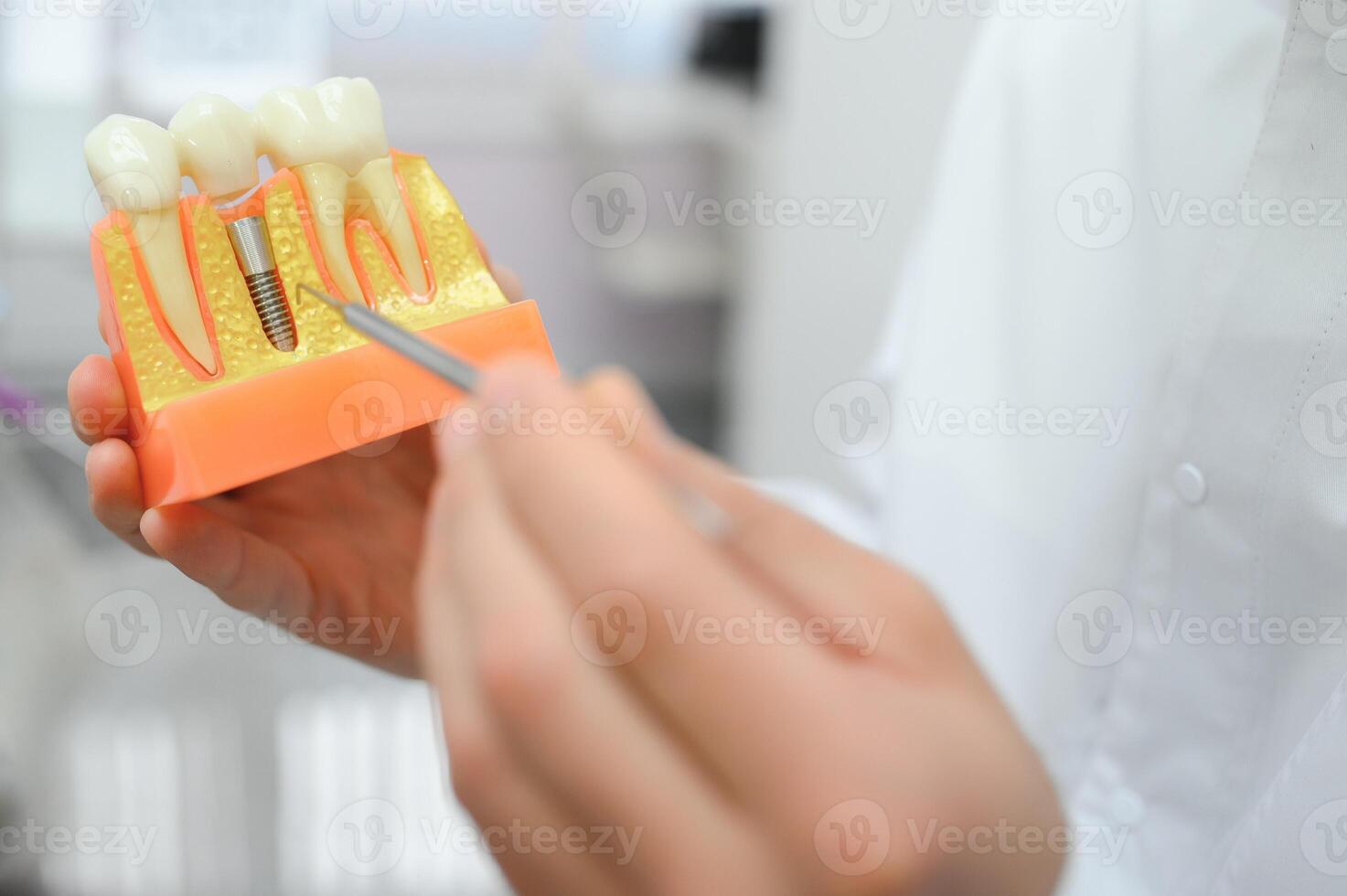 médico mostra em uma plástico dente amostra ou modelo diferente métodos do dentes tratamento foto