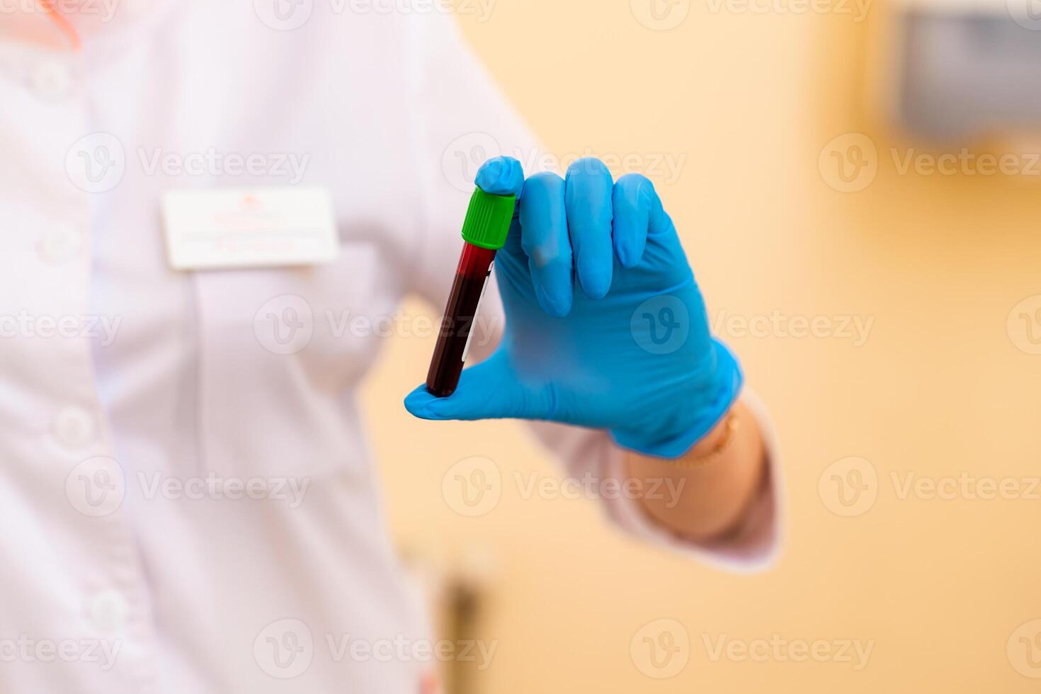 sangue laboratório. doença teste. foto