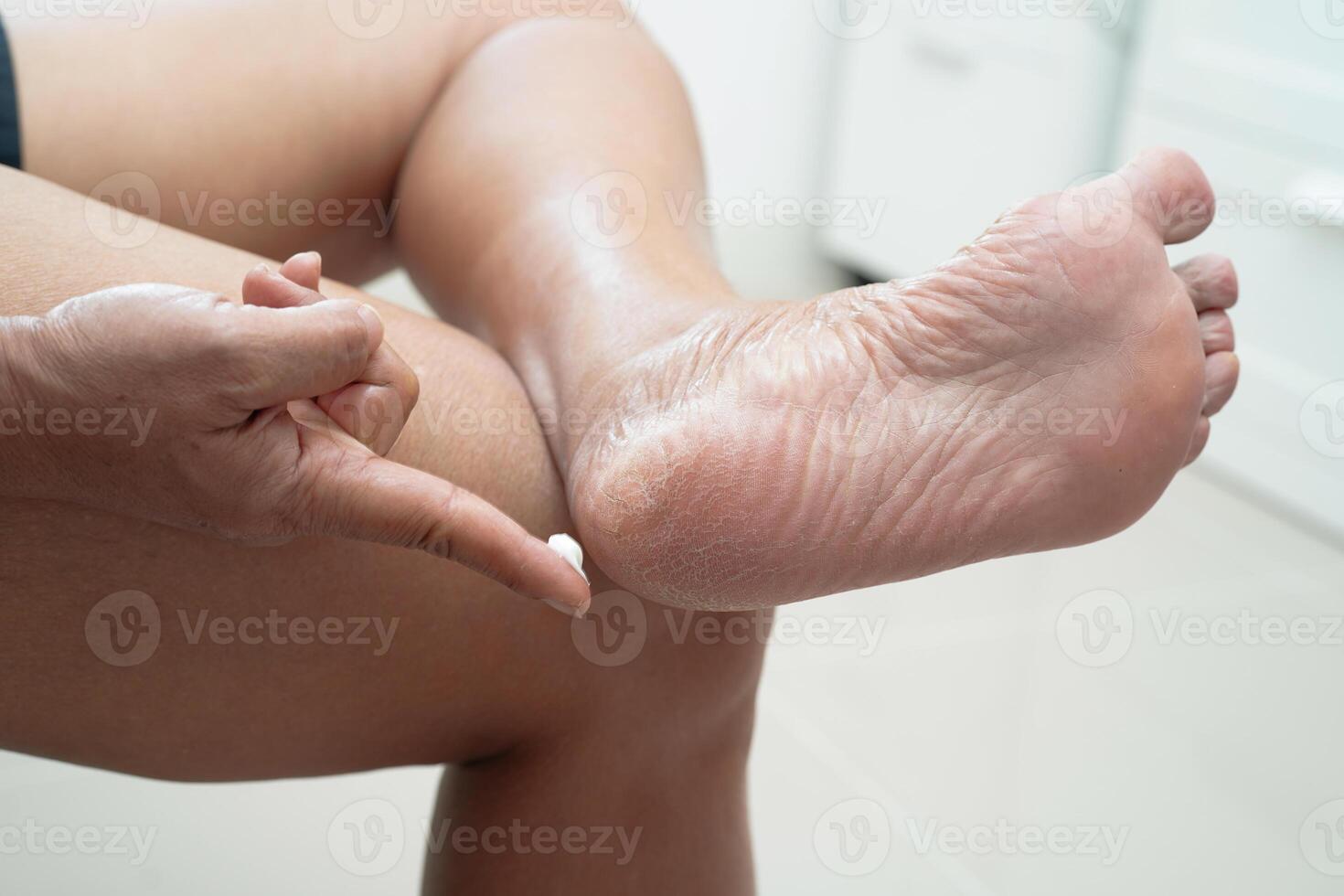 ásia mulher aplicando hidratante creme cuidados com a pele tratamento para resolver e reparar pés com rachadura e seco salto pele. foto