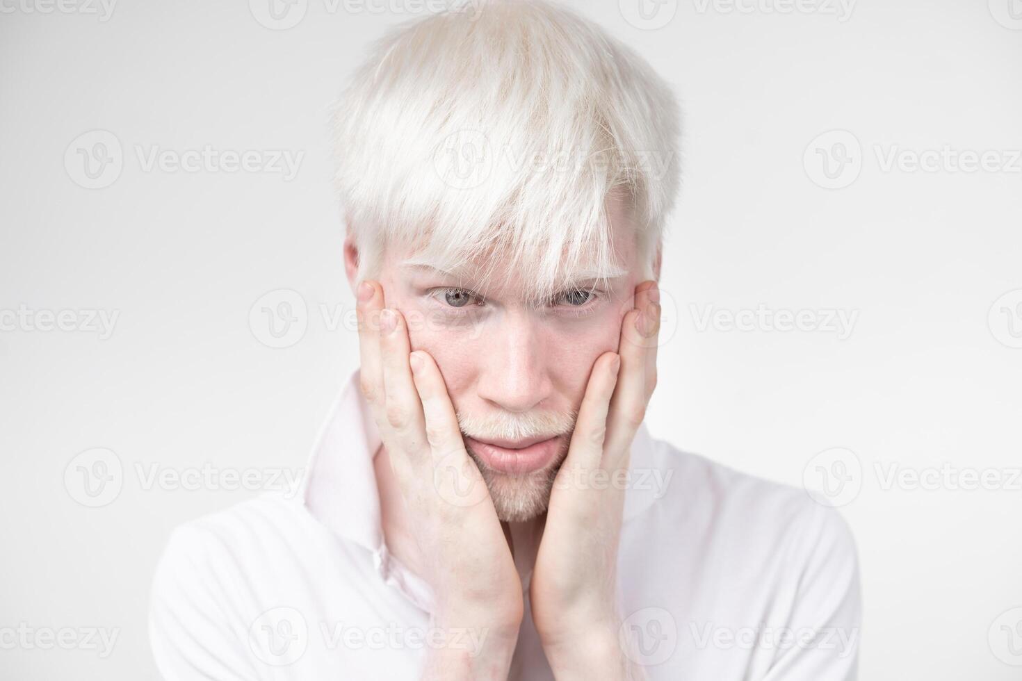 retrato do a albino homem dentro estúdio vestido camiseta isolado em uma branco fundo. anormal desvios. incomum aparência foto