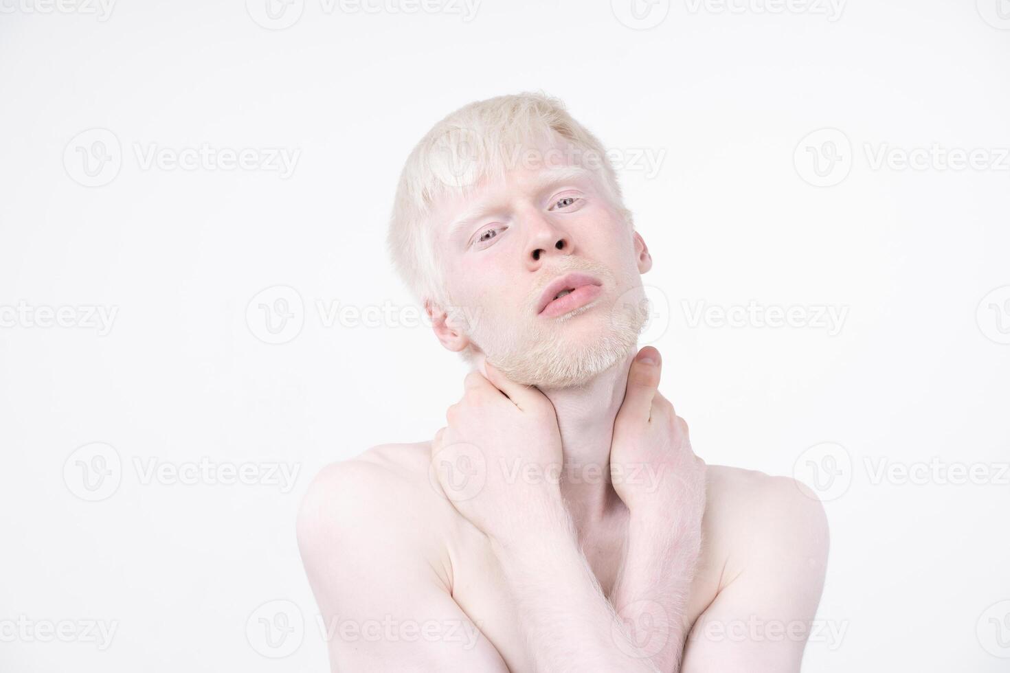 retrato do a albino homem dentro estúdio vestido camiseta isolado em uma branco fundo. anormal desvios. incomum aparência foto