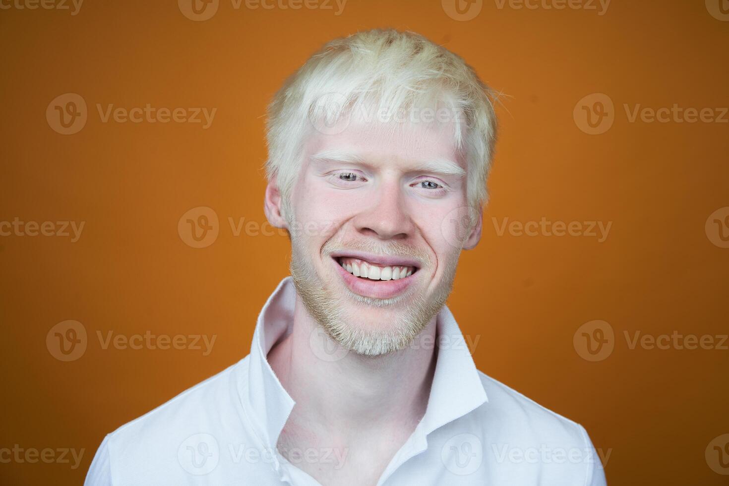 retrato do a albino homem dentro estúdio vestido camiseta isolado em uma amarelo fundo. anormal desvios. incomum aparência foto