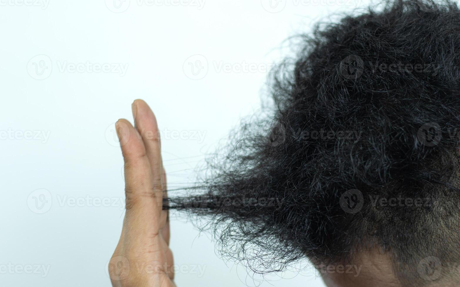 fechar acima jovem pessoas ter problemas com cabelo perda, secura, embotamento, Dividido termina e dano. foto