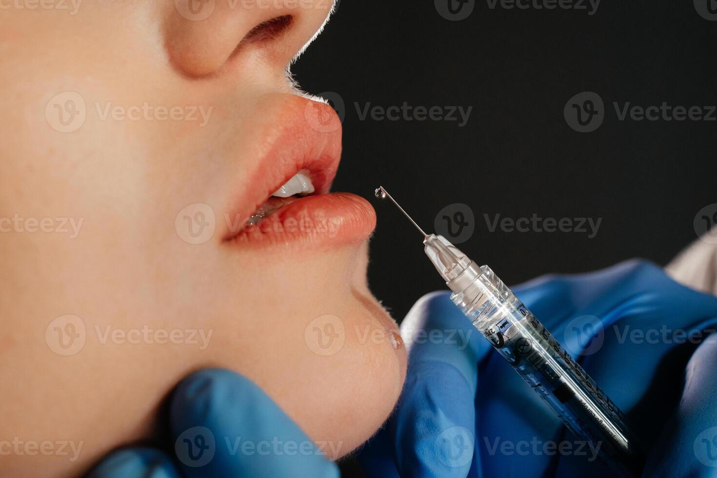 cortada sensual fêmea lábios, procedimento lábio aumento. seringa perto mulher boca, injeções para aumentar lábios forma. Alto qualidade foto