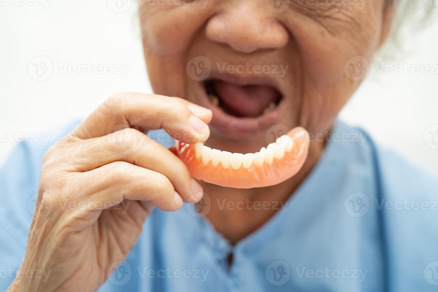 paciente de mulher idosa asiática segurando para usar dentadura, conceito médico forte e saudável. foto