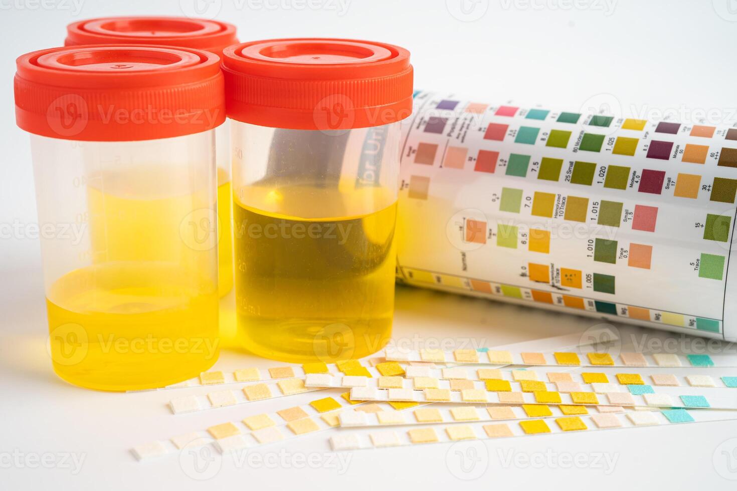 urinálise, urina copo com reagente faixa ph papel teste e comparação gráfico dentro laboratório. foto