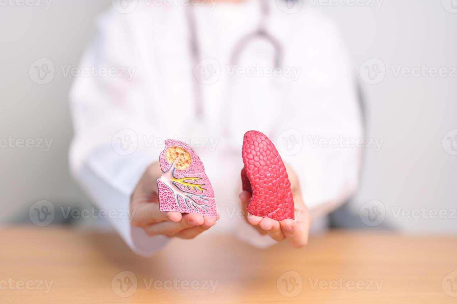 médico com fumante e normal pulmão anatomia para doença. pulmão Câncer, asma, crônica obstrutivo pulmonar ou copd, bronquite, enfisema, cístico fibrose, bronquiectasia, pneumonia e mundo pulmão dia foto