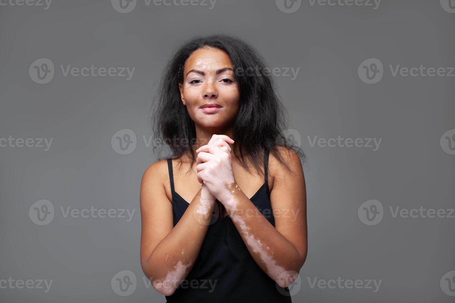 feliz Preto mulher com vitiligo doença dentro cinzento estúdio foto