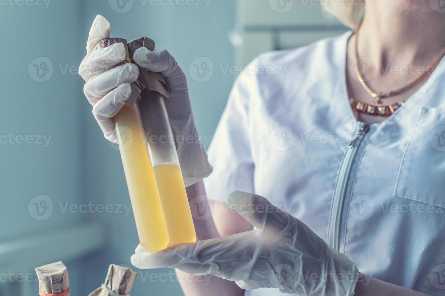 mãos com tubos de ensaio no laboratório foto