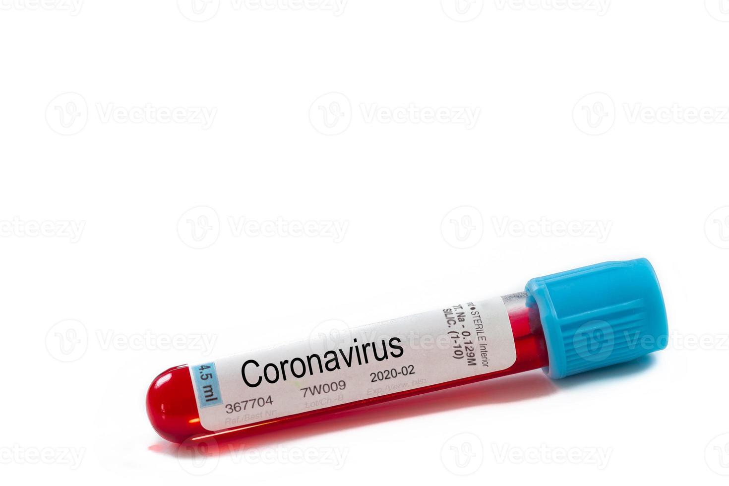 macro amostra de sangue em tubo de ensaio em fundo branco. epidemia mers-cov coronavirus pesquisa e conceito de tratamento foto