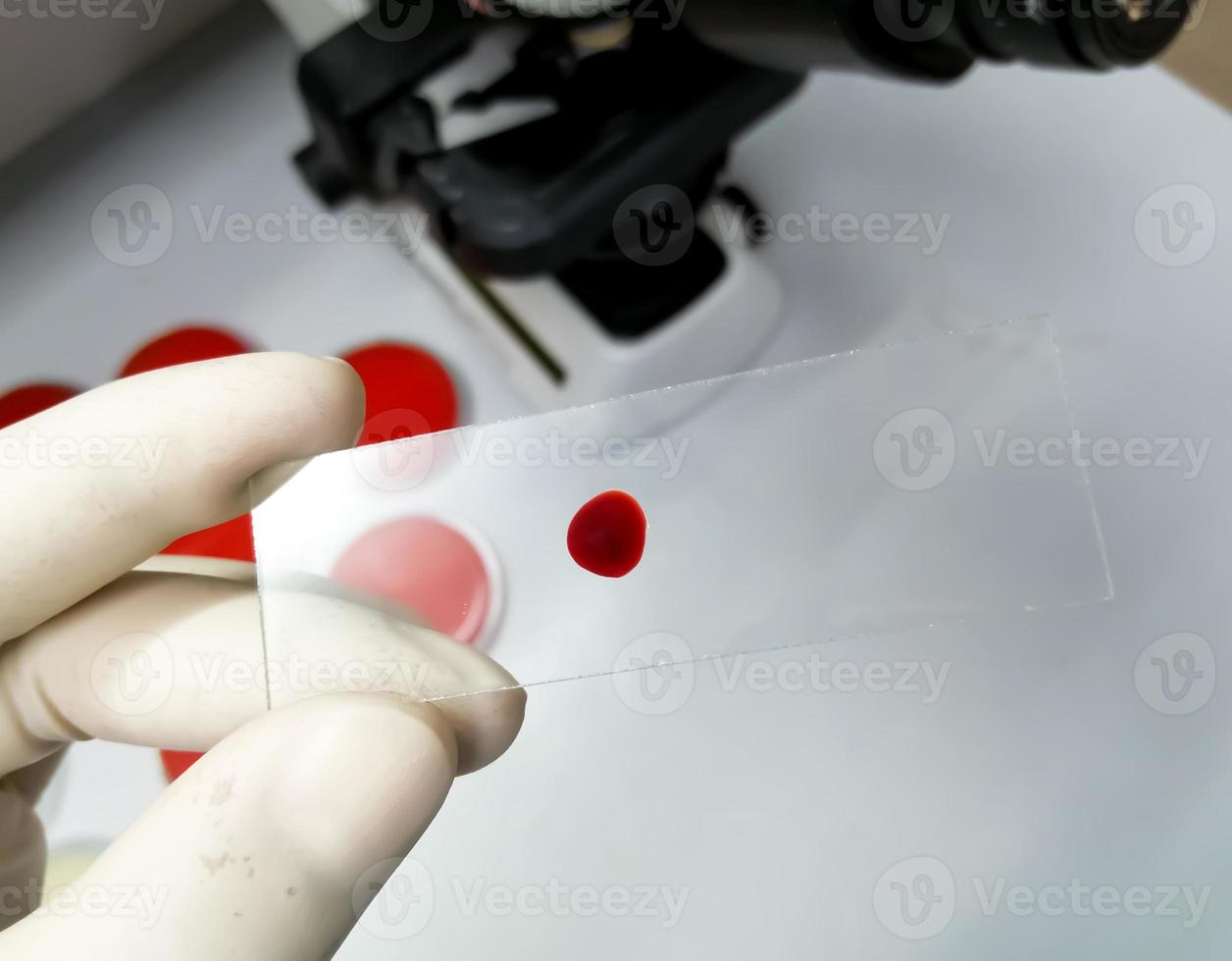 mão do cientista segura a lâmina de vidro com uma gota de sangue para mais testes laboratoriais. foto