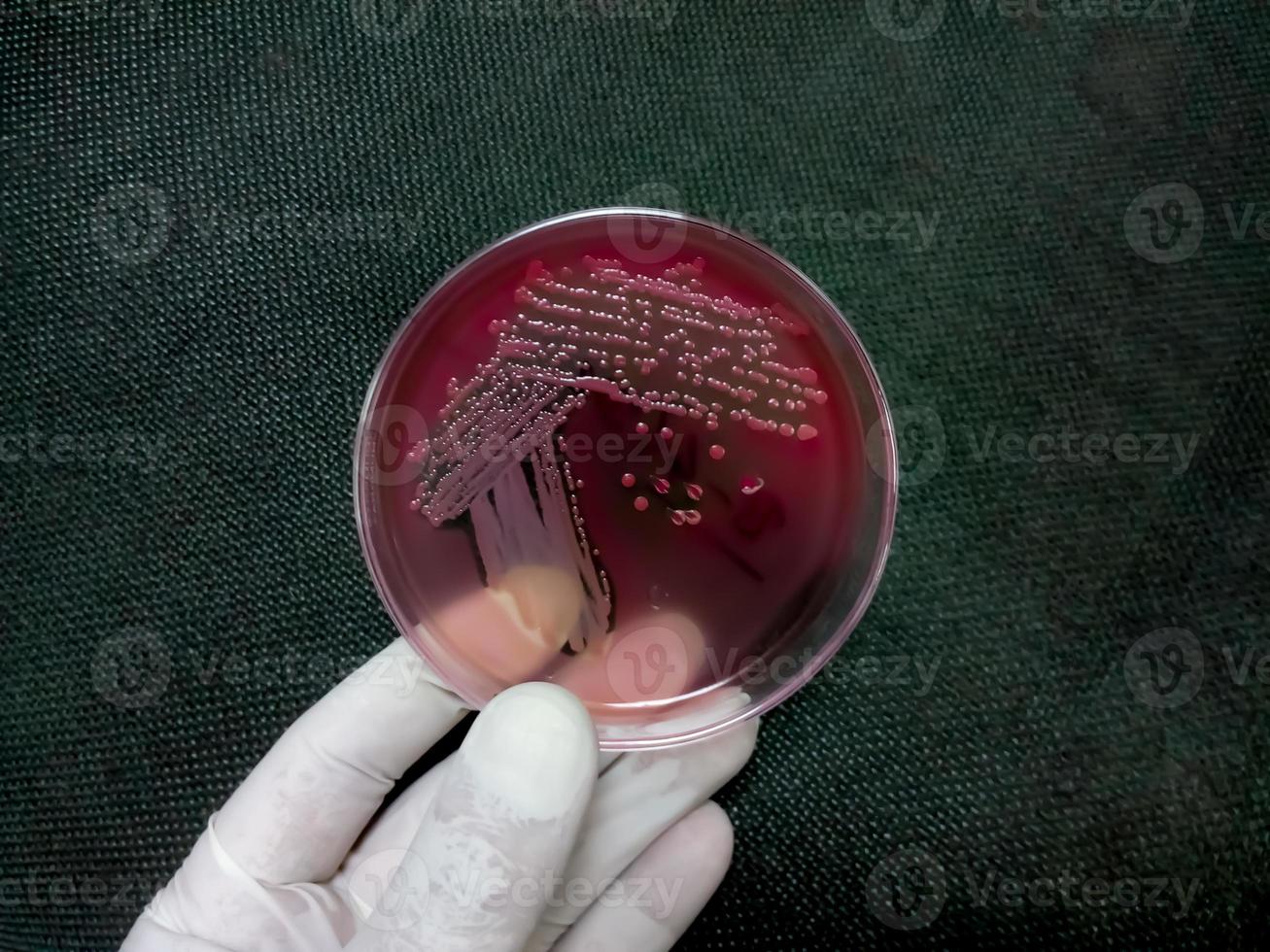 colônias de bactérias em ágar macconkey. placa de meio de cultura. placa de Petri foto