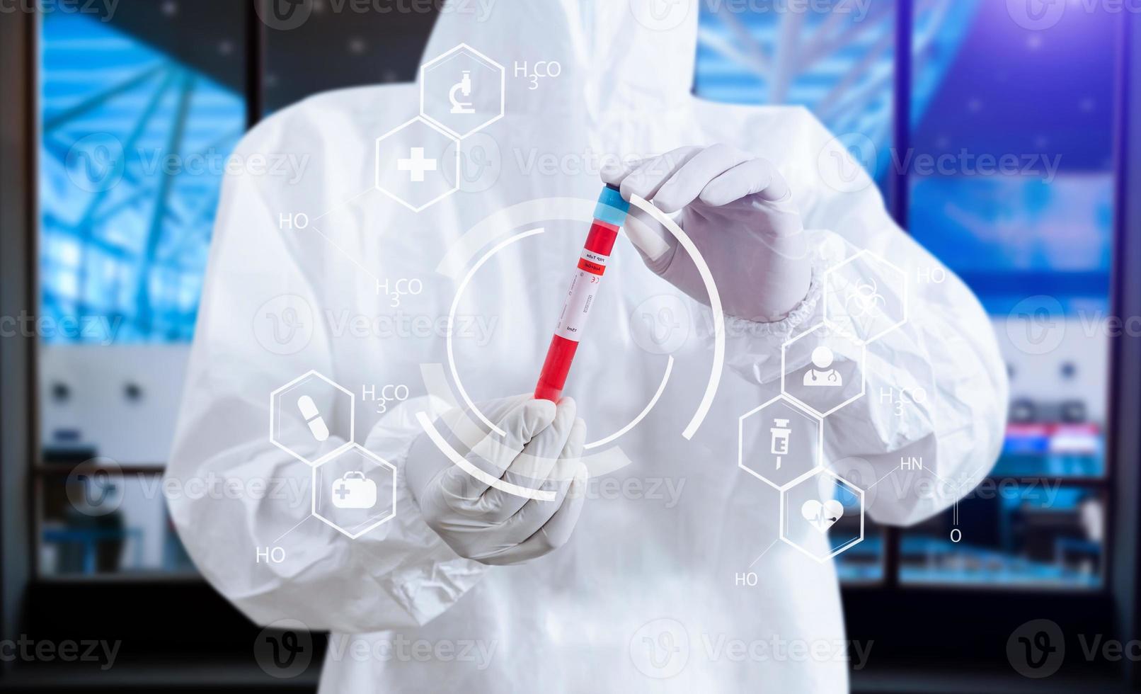exame de sangue coronavírus, médico segurando o conceito de tecnologia médica de tubo de vidro de teste. foto