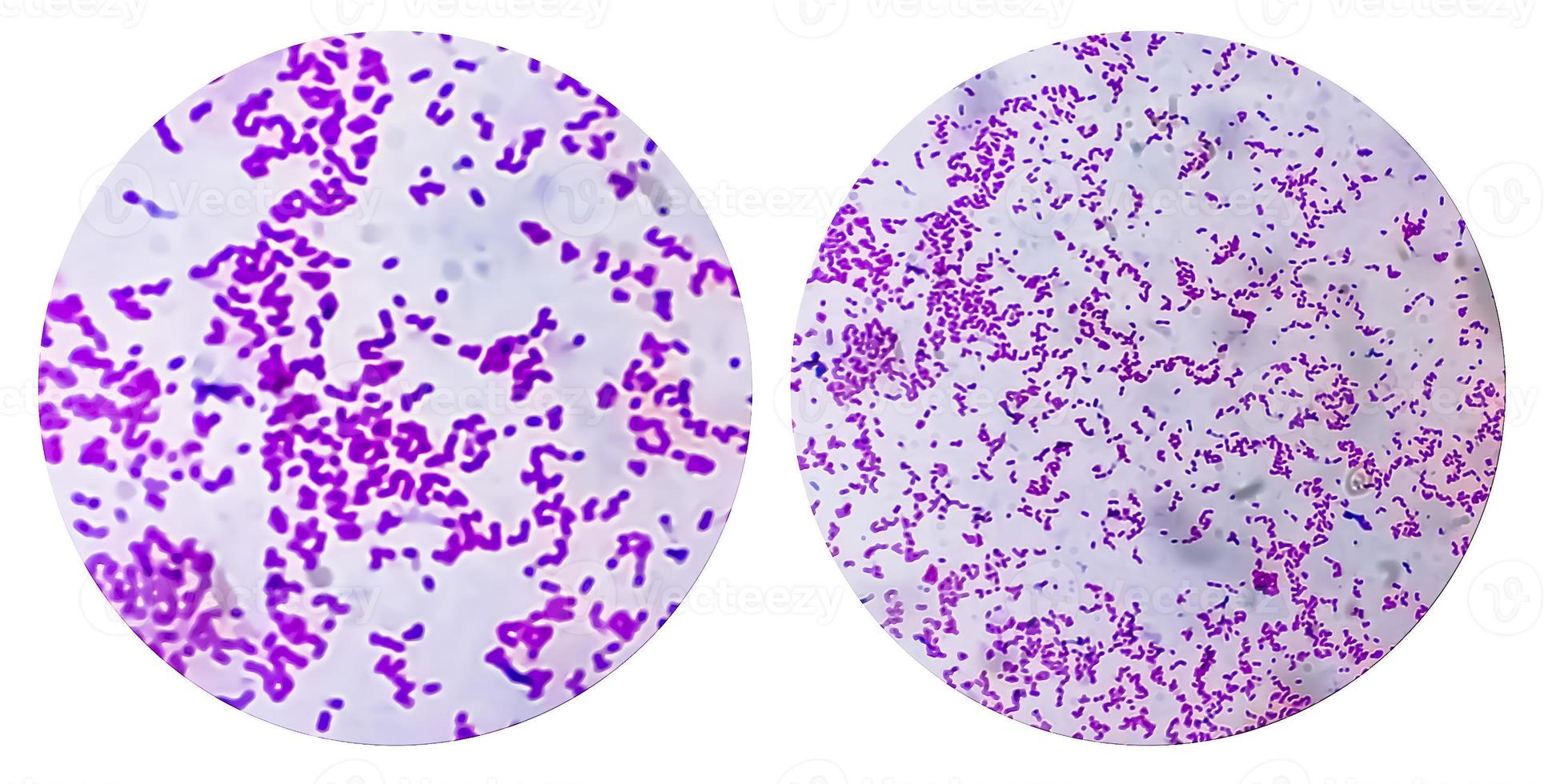 colagem de fotos da bactéria escherichia coli, e.coli, bactérias gram-negativas em forma de bastonete, parte da flora normal intestinal e agente causador de diarréia e inflamações de diferentes localizações.