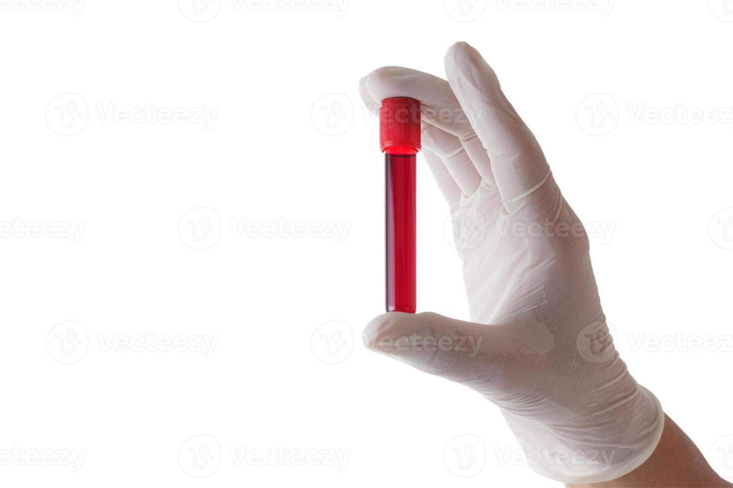 mão segurando um copo de tubo de ensaio com sangue do paciente para teste isolado no fundo branco com traçado de recorte. foto