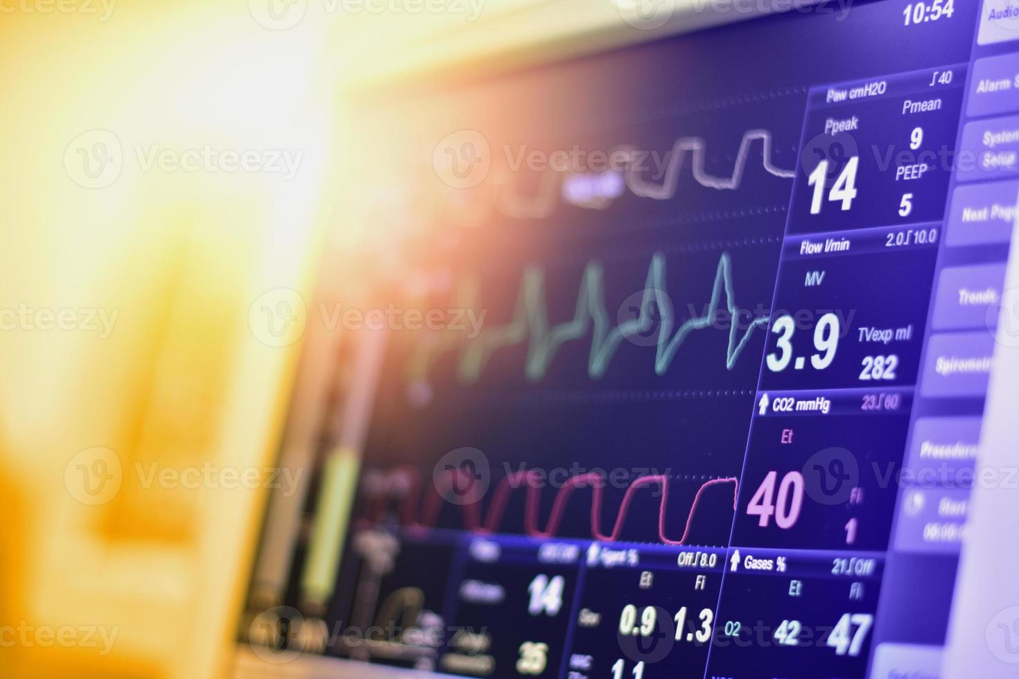 monitor ekg na máquina de bomba de balão intra-aórtico em icu em desfoque de fundo, ondas cerebrais em eletroencefalograma, onda de frequência cardíaca foto