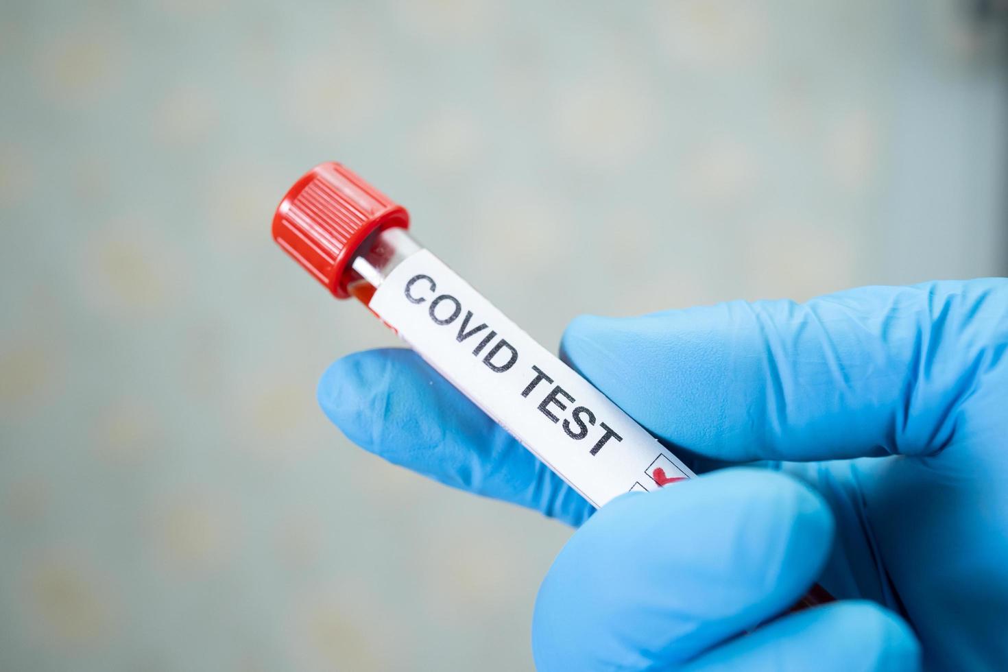 amostra de infecção de sangue positiva em tubo de ensaio para coronavírus covid-19 em laboratório. cientista segurando para verificar e analisar o paciente no hospital. foto