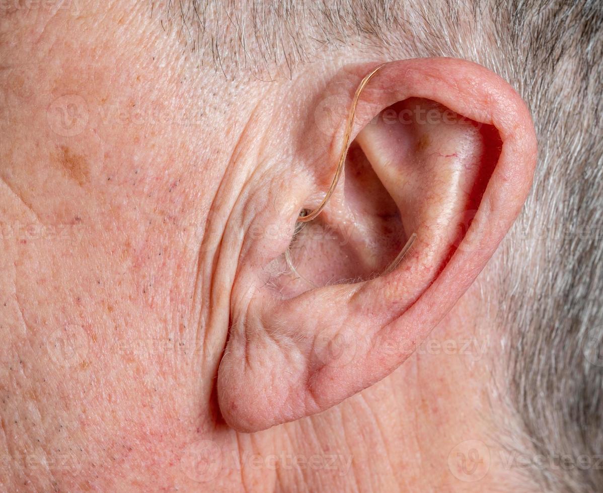 close-up de um pequeno aparelho auditivo moderno atrás da orelha foto