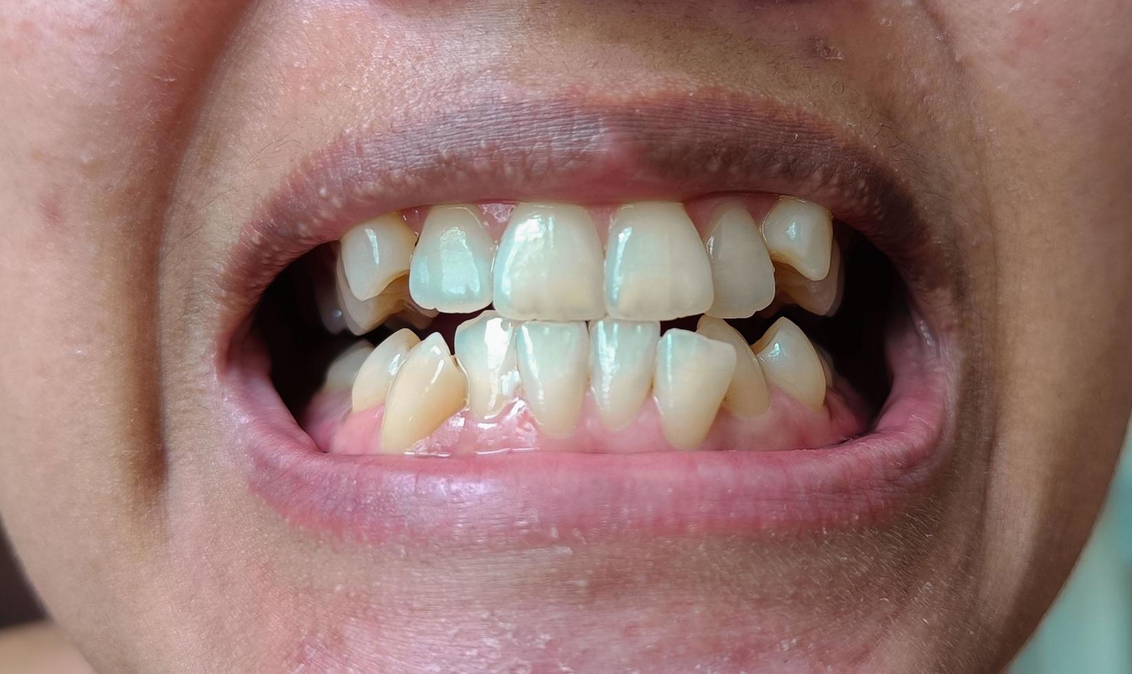 foco nos dentes mulher amarela foto