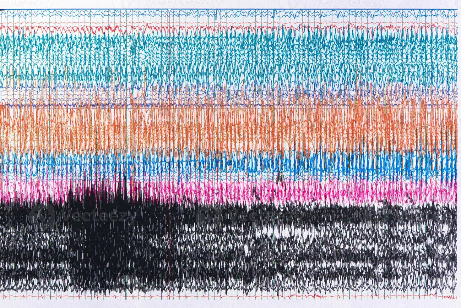 fotografia de ondas cerebrais durante a convulsão. foto