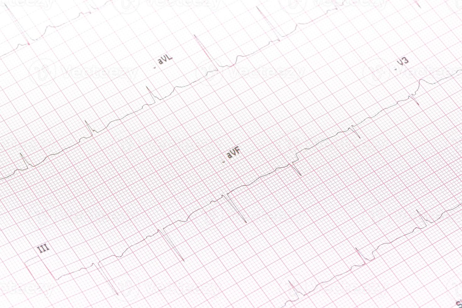 eletrocardiograma close-up foto