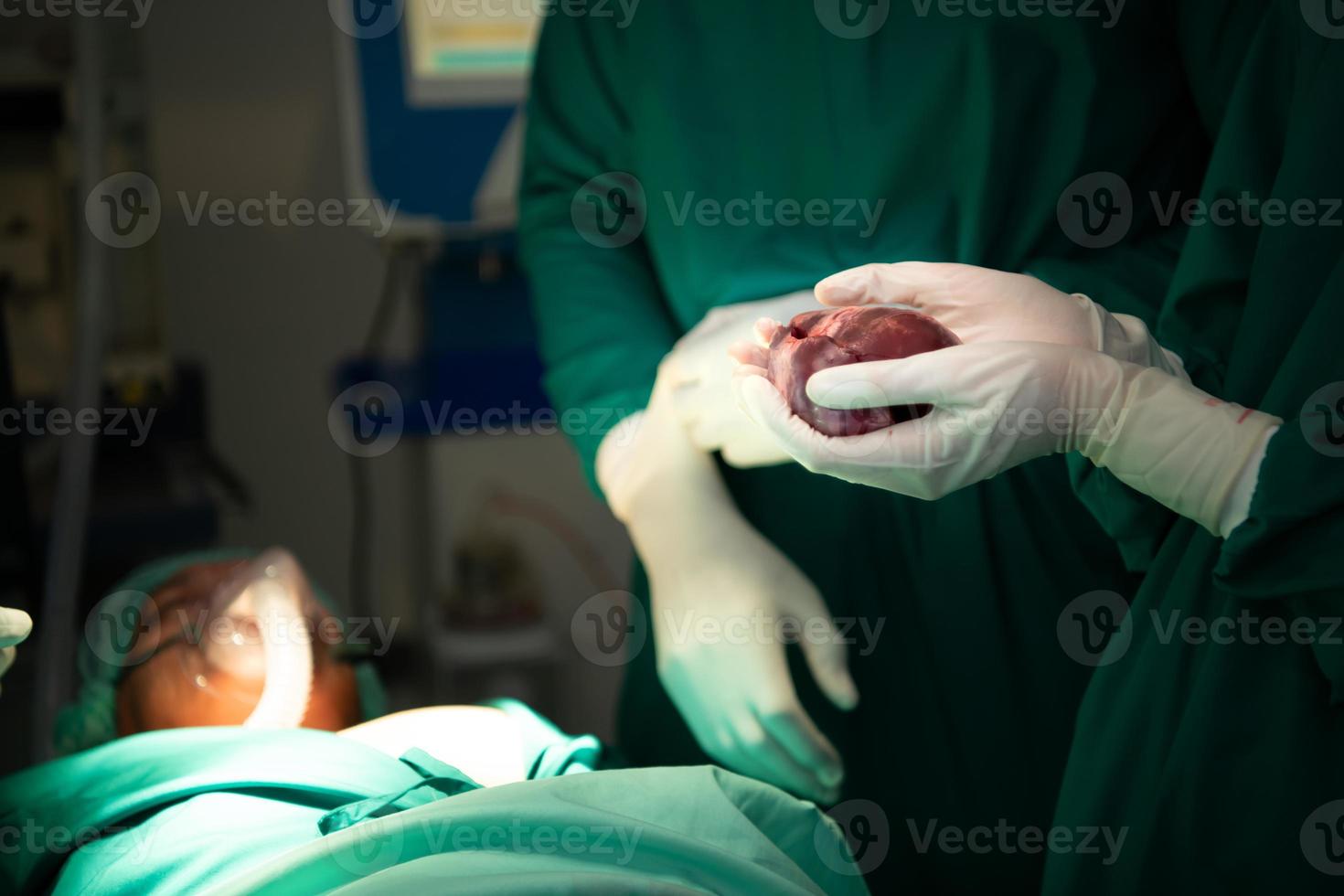 professor de medicina em cardiologia e uma equipe de médicos na sala de cirurgia submetidos a cirurgia de transplante de coração foto