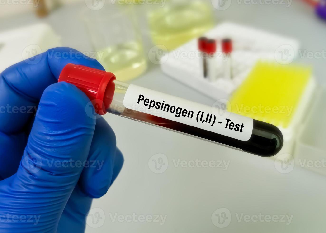 cientista segura amostra de sangue para teste de pepsinogênio ou pg ii, diagnóstico para detecção precoce de câncer gástrico foto