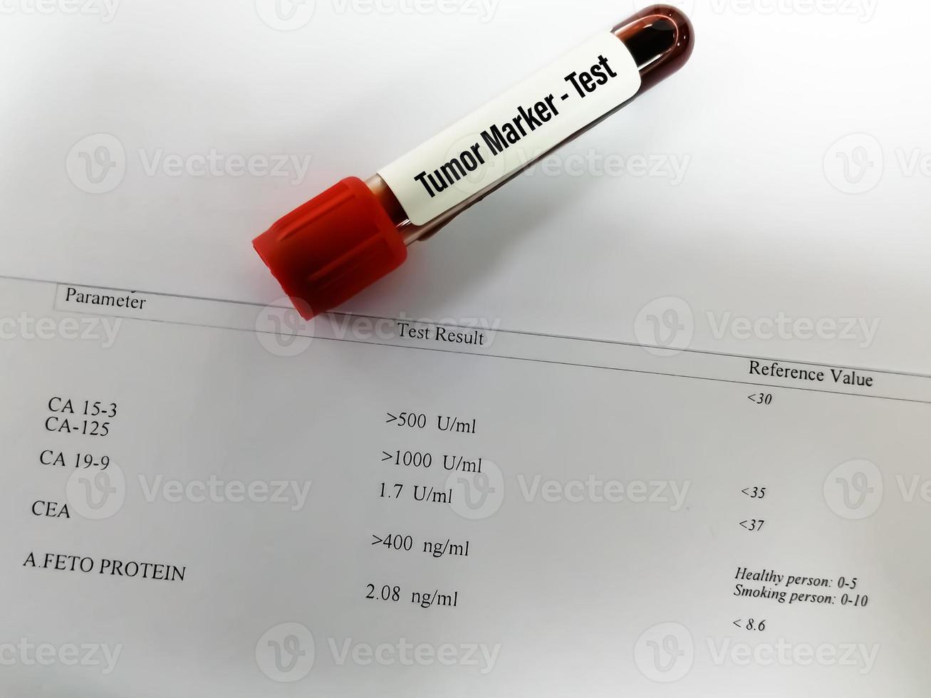 amostra de sangue para marcador de câncer incluindo ca 125, ca 15,3, ca 19,9, afp e teste cea com relatório laboratorial. teste de marcadores tumorais. foto