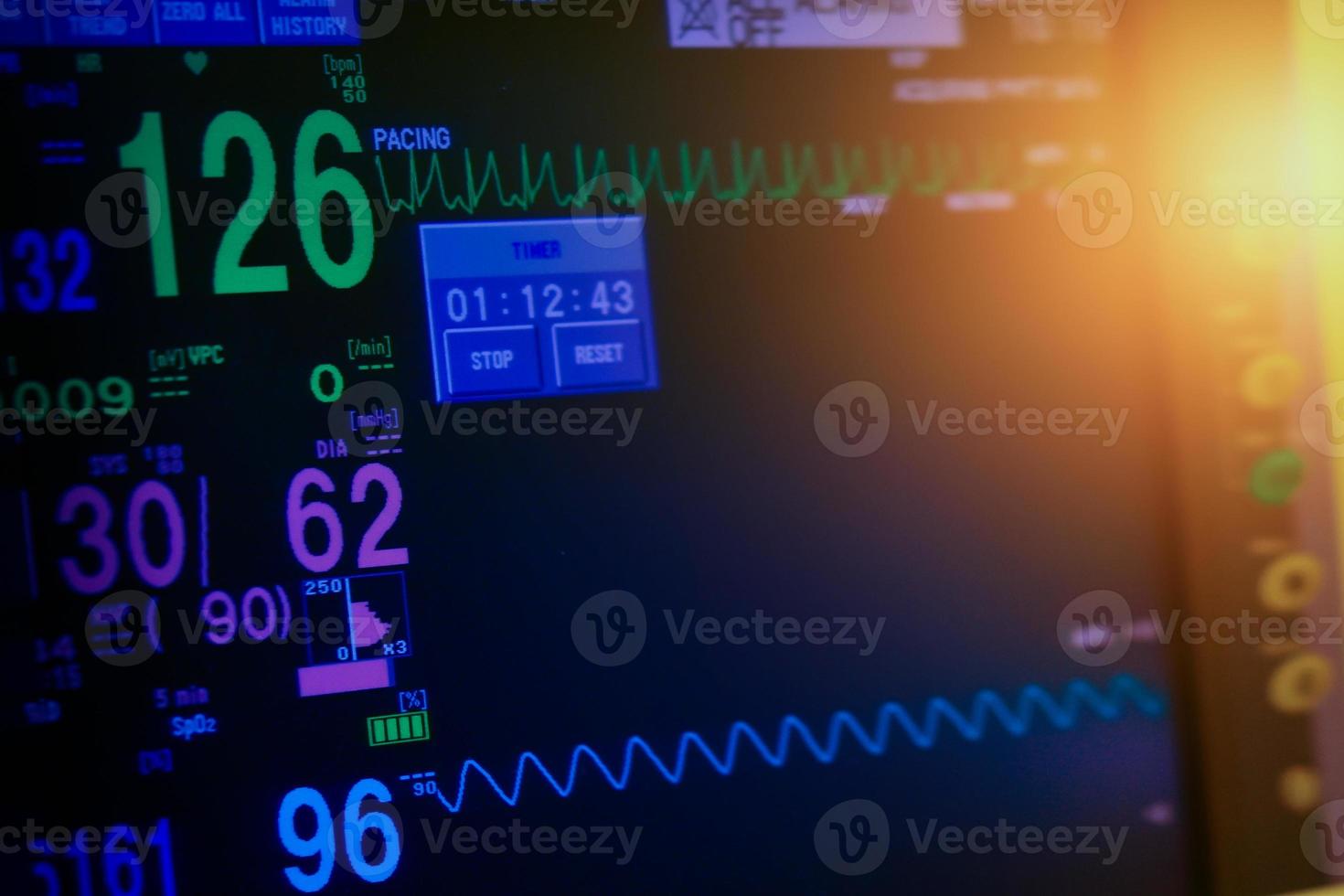 monitor ekg na máquina de bomba de balão intra-aórtico em icu em desfoque de fundo, ondas cerebrais em eletroencefalograma, onda de frequência cardíaca foto