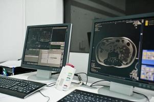 tema médico. centro de ressonância magnética no hospital, monitores de computador com cérebro humano nele. foto
