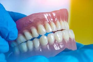 prótese dentária nas mãos do médico close-up. dentista segurando a ponte dental cerâmica. vista frontal da prótese total. foto conceitual de odontologia. prótese dentária.