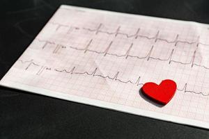 close-up de um eletrocardiograma em papel com coração de madeira vermelho. papel ecg ou ekg em fundo preto. conceito médico e de saúde. foto