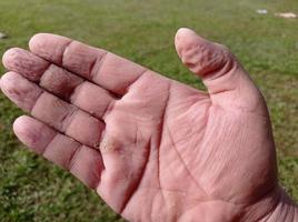 a pele das palmas está enrugada e molhada de água, submersa em água por muito tempo. foto