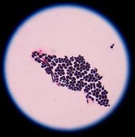 células de levedura que brotam com pseudo-hifas