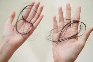 mulher asiática tem problema com perda de cabelo comprido anexado na mão. foto