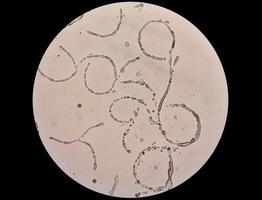 imagem microscópica mostrando hifas de dermatófitos, raspagem de pele para teste de fungos foto