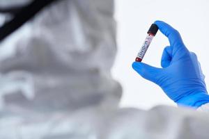 coronavírus, médico segurando o fundo branco do tubo de amostra de sangue do vírus covid-19 positivo foto