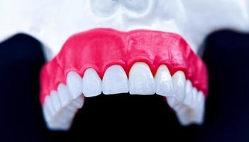 maxilar humano superior com modelo de anatomia de dentes e gengivas foto